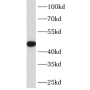 abx236807