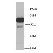 WB analysis of SW620 cells, using PRPF19 antibody (1/1000 dilution).