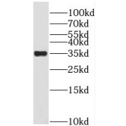 WB analysis of Jurkat cells, using PRPS1 antibody (1/400 dilution).