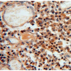 Phosphoribosyl Pyrophosphate Synthase-Associated Protein 1 (PRPSAP1) Antibody