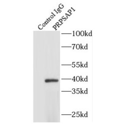Phosphoribosyl Pyrophosphate Synthase-Associated Protein 1 (PRPSAP1) Antibody