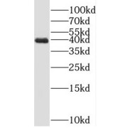 WB analysis of human testis tissue, using PRPSAP1 antibody (1/800 dilution).