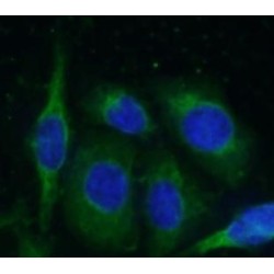 Prosaposin (PSAP) Antibody