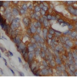 Prosaposin (PSAP) Antibody