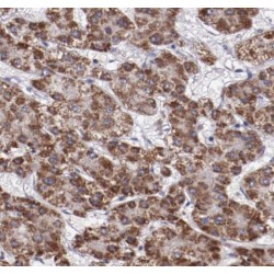 Prosaposin (PSAP) Antibody