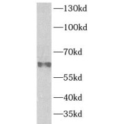 WB analysis of HepG2 cells, using PSAP antibody (1/600 dilution).