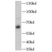 WB analysis of HepG2 cells, using PSAP antibody (1/600 dilution).