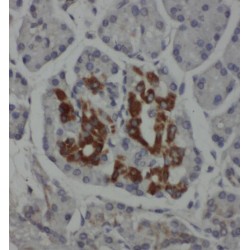 Phosphoserine Aminotransferase 1 (PSAT1) Antibody