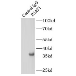 Phosphoserine Aminotransferase 1 (PSAT1) Antibody