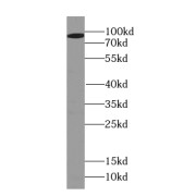 WB analysis of mouse brain tissue, using PSD2 antibody (1/1500 dilution).