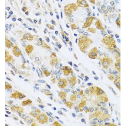Pregnancy Specific Beta-1-Glycoprotein 1 (PSG1) Antibody