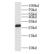 WB analysis of human lung tissue, using PSMA3 antibody (1/400 dilution).