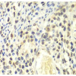 Proteasome Subunit Alpha Type 4 (PSMA4) Antibody