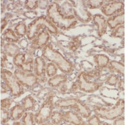 Proteasome Subunit Alpha 8 (PSMA8) Antibody