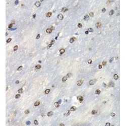Proteasome Subunit Beta Type 10 (PSMB10) Antibody