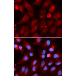 Proteasome Subunit Beta Type 2 (PSMB2) Antibody