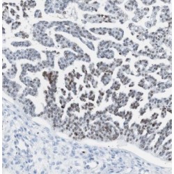 Proteasome Subunit Beta Type 2 (PSMB2) Antibody