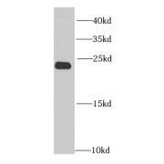 WB analysis of Jurkat cells, using PSMB2 antibody (1/1000 dilution).