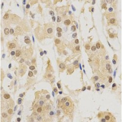 Proteasome Subunit Beta Type 5 (PSMB5) Antibody