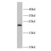 WB analysis of L02 cells, using PSMB5 antibody (1/1000 dilution).