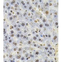 26S Proteasome Regulatory Subunit 6A (PSMC3) Antibody
