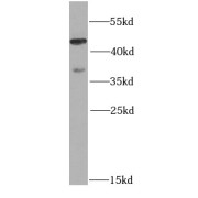 WB analysis of HeLa cells, using PSMC3 antibody (1/1000 dilution).
