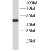 WB analysis of human skeletal muscle tissue, using PSMC4 antibody (1/500 dilution).