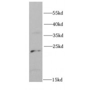 WB analysis of SW620 cells, using PSMD10 antibody (1/1000 dilution).