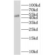 WB analysis of HeLa cells, using PSMD11 antibody (1/1000 dilution).