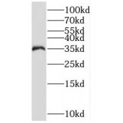 WB analysis of human heart tissue, using PSMD14 antibody (1/400 dilution).
