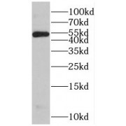 WB analysis of K-562 cells, using PSMD4 antibody (1/3000 dilution).