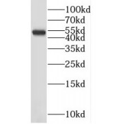 WB analysis of mouse liver tissue, using PSMD5 antibody (1/1000 dilution).