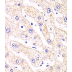 Proteasome Inhibitor Subunit 1 (PSMF1) Antibody