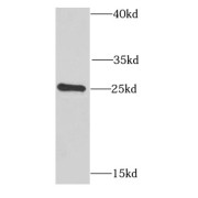 WB analysis of HeLa cells, using PSPH antibody (1/1000 dilution).