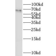 WB analysis of RAW 264.7 cells, using PSTPIP2 antibody (1/500 dilution).