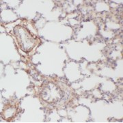 abx236905