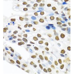 Polypyrimidine Tract-Binding Protein 1 (PTBP1) Antibody