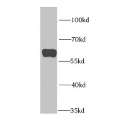WB analysis of Jurkat cells, using PTBP1 antibody (1/1000 dilution).