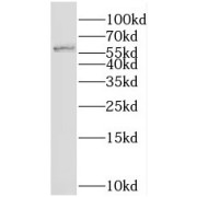 WB analysis of BxPC-3 cells, using PTBP1 antibody (1/3000 dilution).