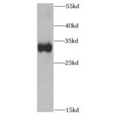 abx236914