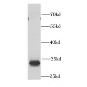 WB analysis of HeLa cells, using PTGES2 antibody (1/1000 dilution).