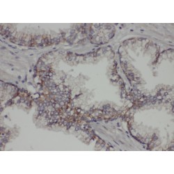 protein Tyrosine Phosphatase 1B (PTP1B) Antibody