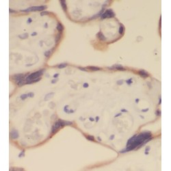 Tyrosine-Protein Phosphatase Non-Receptor Type 14 (PTPN14) Antibody