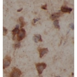 Protein Tyrosine Phosphatase, Non Receptor Type 18 (PTPN18) Antibody
