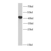 WB analysis of mouse thymus tissue, using PTPN2 antibody (1/1000 dilution).