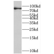 WB analysis of Jurkat cells, using PTPN22 antibody (1/600 dilution).