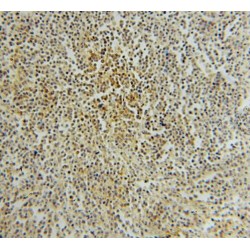 Protein Tyrosine Phosphatase, Non Receptor Type 7 (PTPN7) Antibody