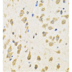 Receptor-Type Tyrosine-Protein Phosphatase Epsilon (PTPRE) Antibody