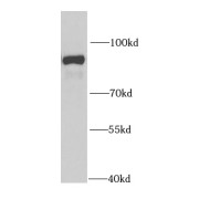 abx236944