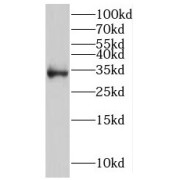 abx236947